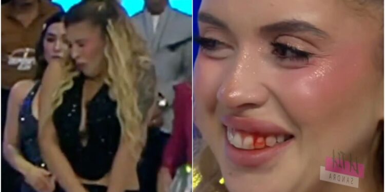 mulher foi atingida por drone após de chute de apresentador, e ela ficou com a boca sangrando