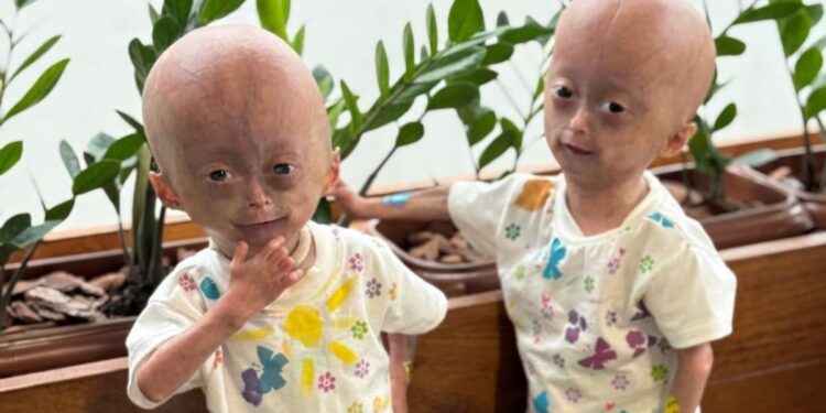 Elis e Eloá