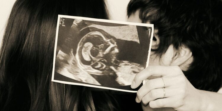 Sasha e João Lucas com a foto do ultrassom que mostra a gravidez