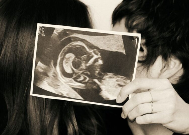 Sasha e João Lucas com a foto do ultrassom que mostra a gravidez
