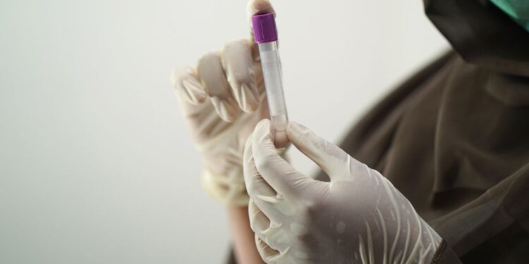 exame de sangue