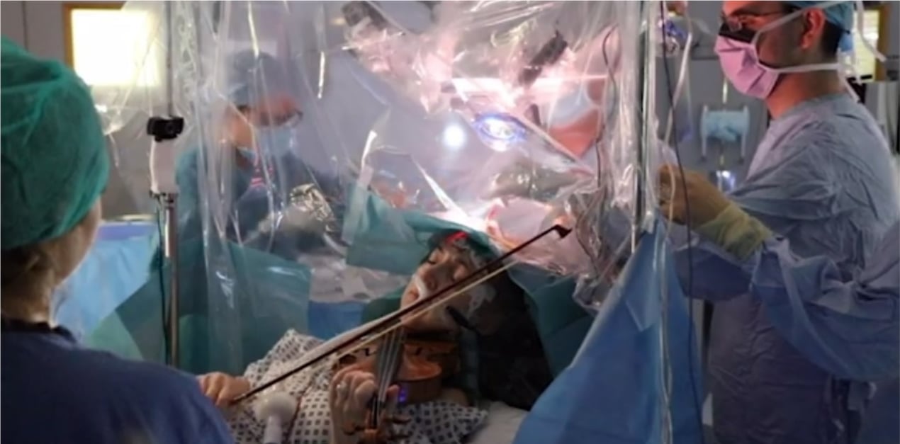 paciente toca violino durante cirurgia