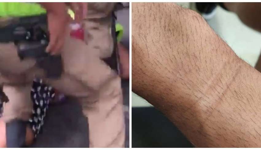 Advogado denuncia agressão de PMs no Carnval
