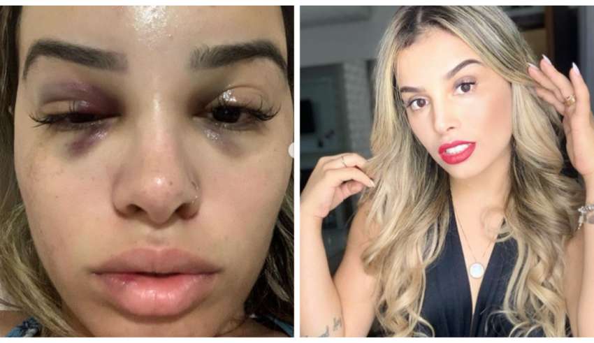 mulher espancada por ex no trabalho