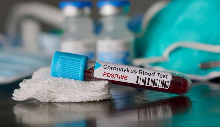 casos mortes covid-19 coronavirus