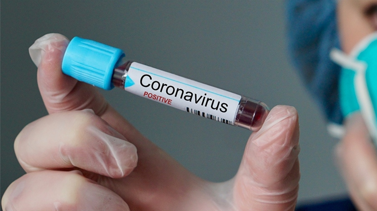 mortes coronavírus
