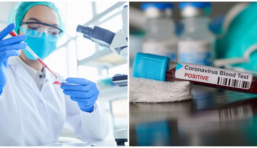 coronavírus covid pandemia