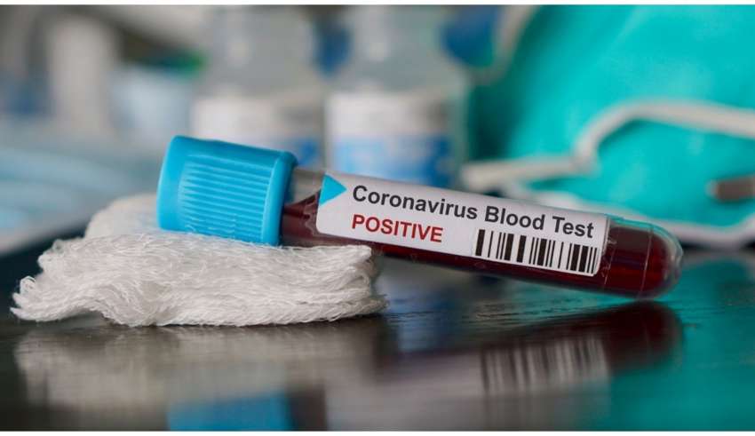 Dado foi divulgado em Boletim Epidemiológico