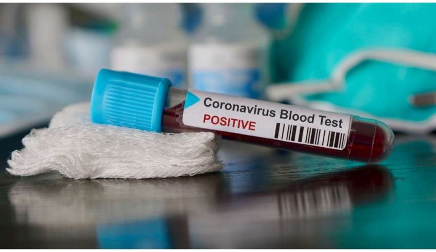Brasil chegou a 105.222 mil pessoas infectadas pela Covid-19