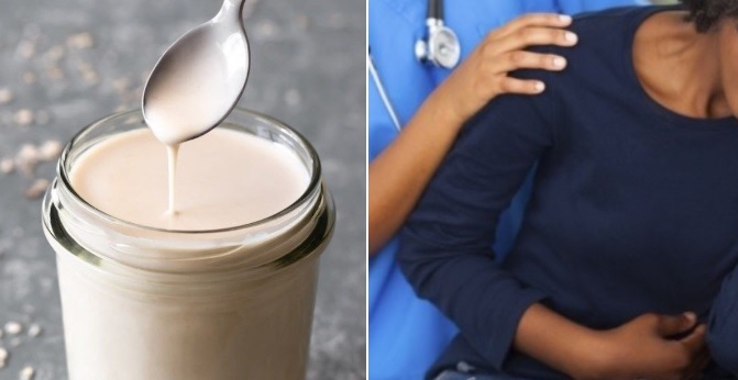 Creme de leite provoca intoxicação alimentar e rende indenização