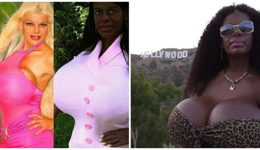 modelo injecao melanina negra revolta branco