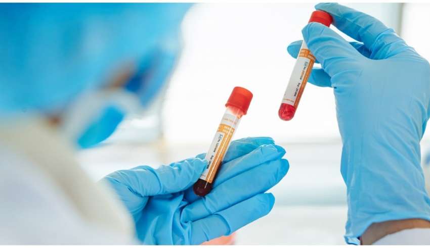 Próximo passo é a produção dos testes