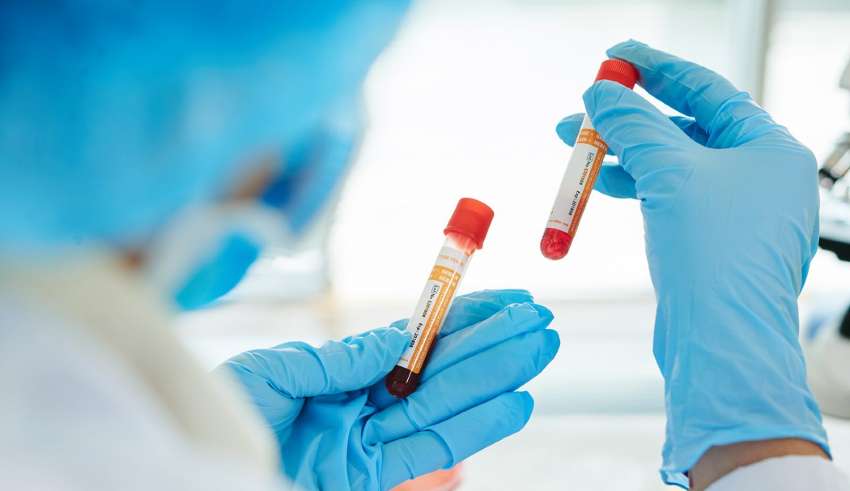 tubos sangue luvas
