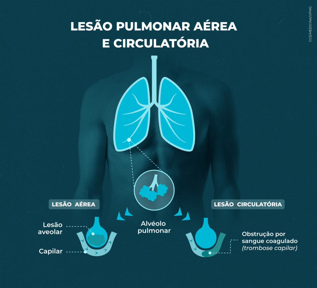 Lesão pulmonar aérea e circulatória