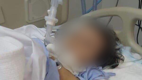 Criança hospitalizada com um contonete de exame da Covid-19 no nariz