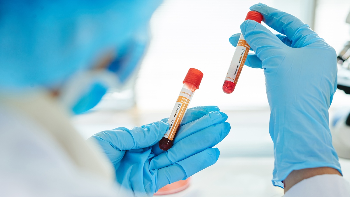 laboratório exame sangue profissional com luvas