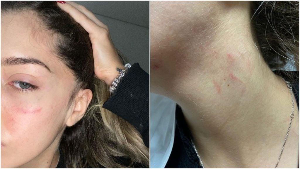 estudante denuncia agressão