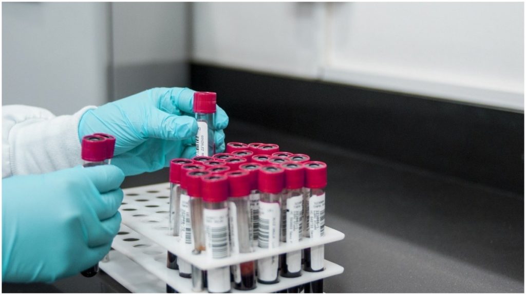 teste laboratório