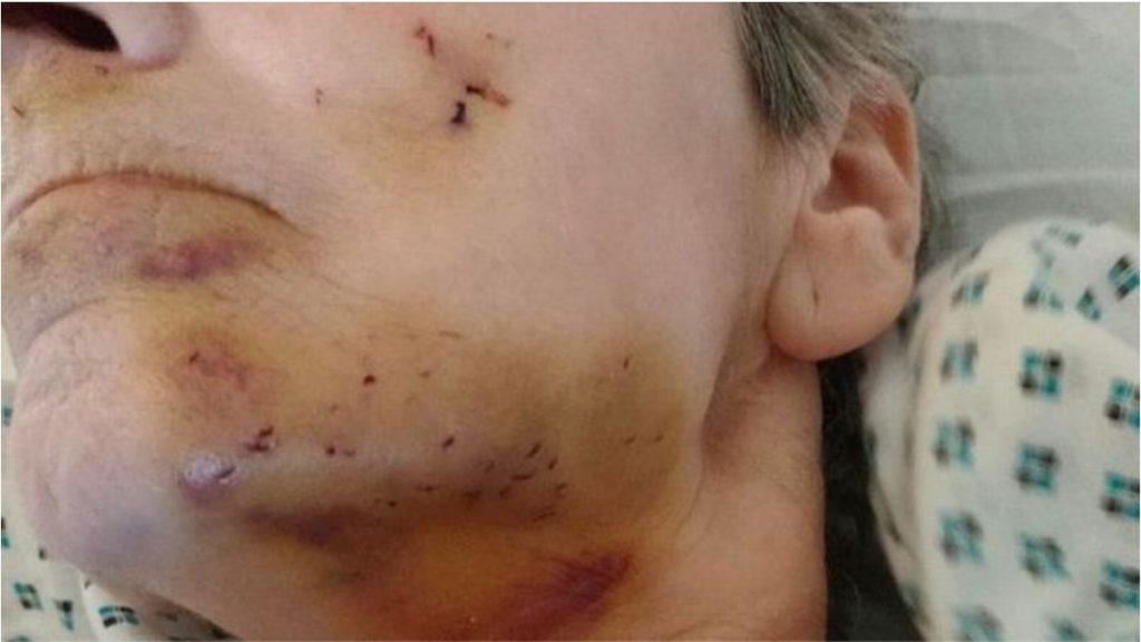 Idosa possui mal de Parkinson e não pode mexer-se