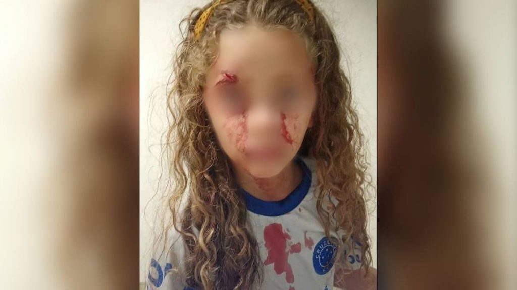 menina atingida cadeira mineirão
