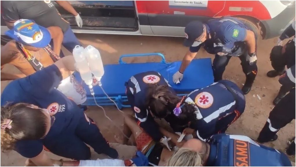 surfista em estado grave ataque de tubarão