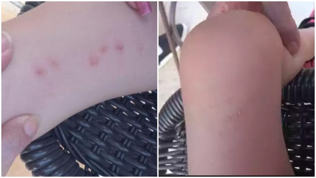 criança autista agredida emei bh