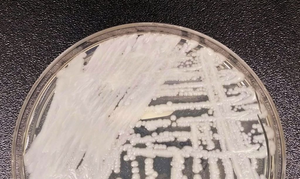 Superfungo Candida auris