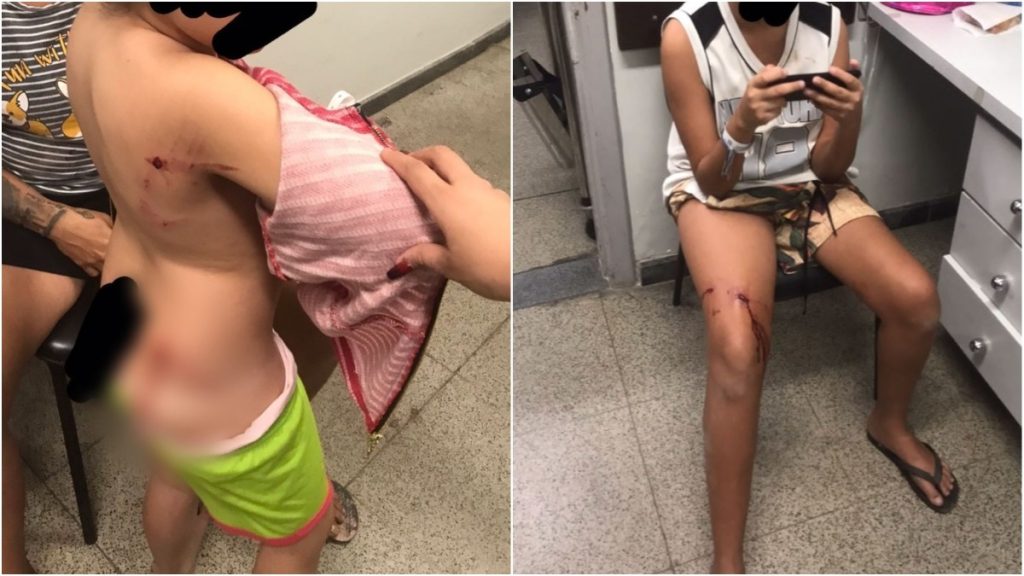 menores de idade mordidos por pitbull em bh