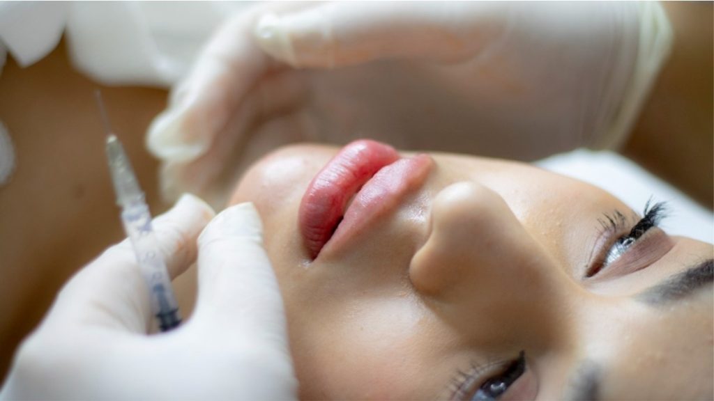 preenchimento facial