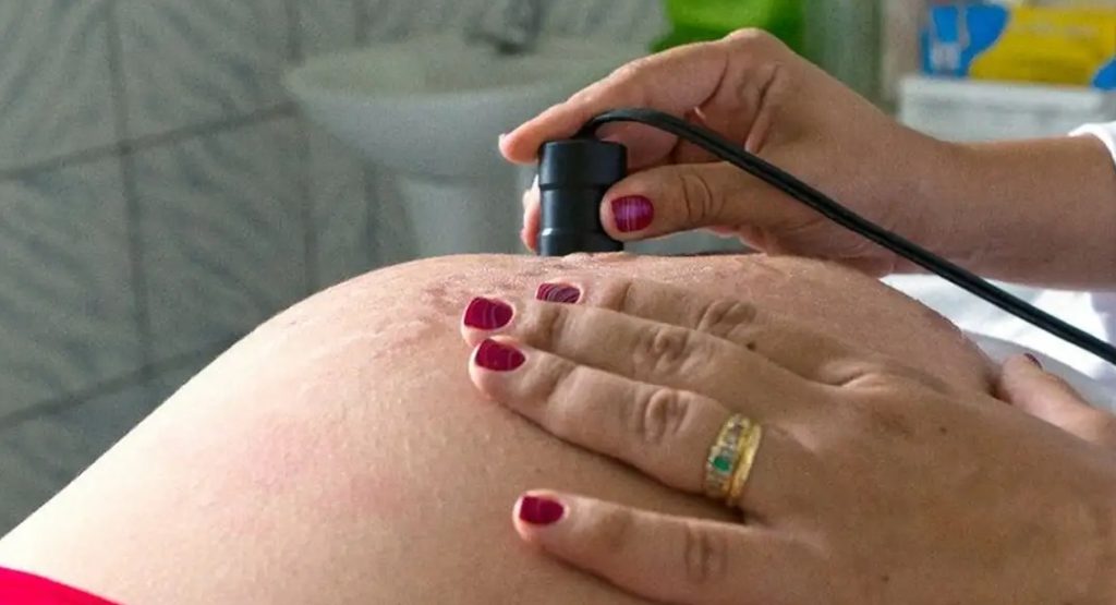 aborto sem limite temporal