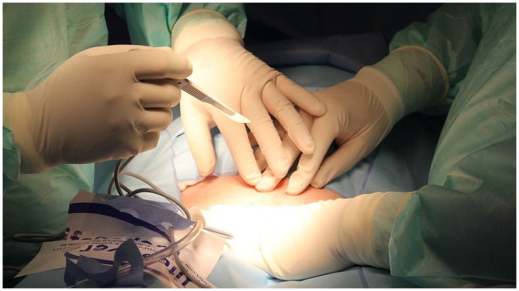paciente indenizada erro médico