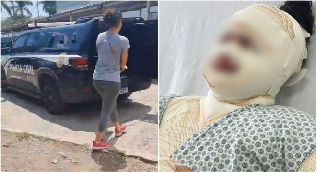 Mulher é presa por voltar a ameaçar atual namorada do ex dela, mesmo após jogar água fervente no rosto da vítima