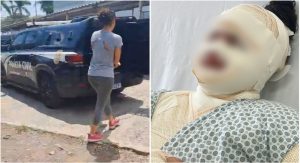Mulher é presa por voltar a ameaçar atual namorada do ex dela, mesmo após jogar água fervente no rosto da vítima
